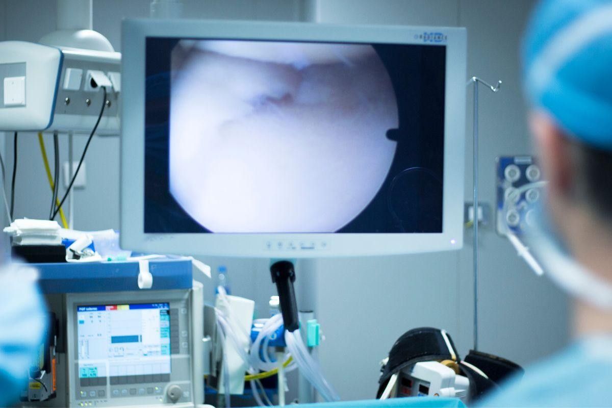 Inspeção articular do ombro por artroscopia: o que o exame revela?