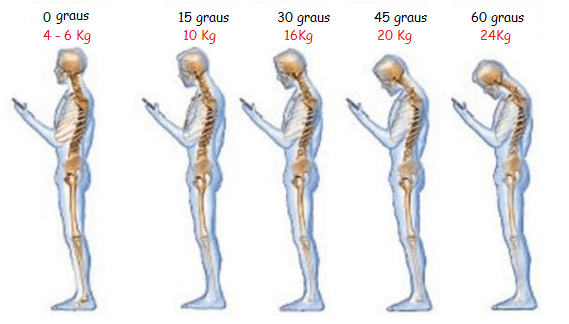 Um diagrama do esqueleto de uma pessoa segurando um telefone celular
