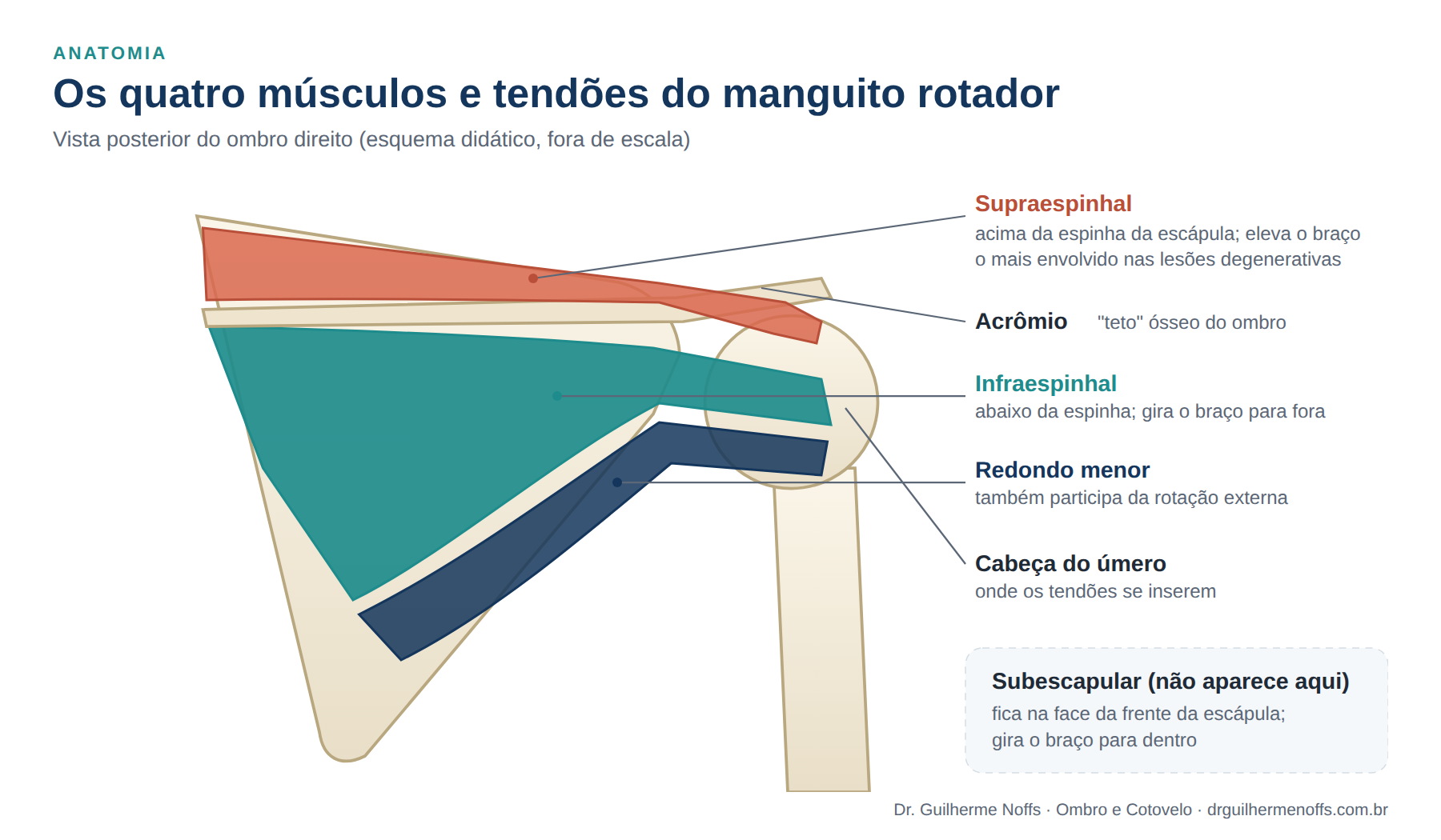 Figura 2. Os quatro componentes do manguito rotador. O supraespinhal, acima da espinha da escápula, é o tendão mais envolvido nas lesões degenerativas.

