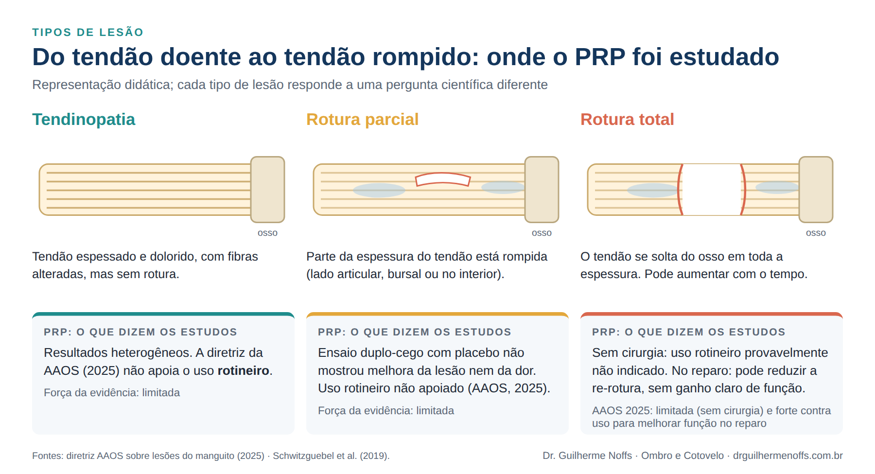 Figura 5. Cada tipo de lesão responde a uma pergunta diferente. Sem cirurgia, a evidência a favor do PRP é limitada nos três cenários.
