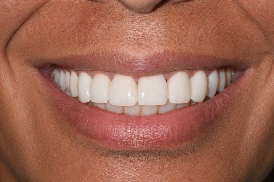 Close-up of a smiling mouth with bright white teeth and pink lips