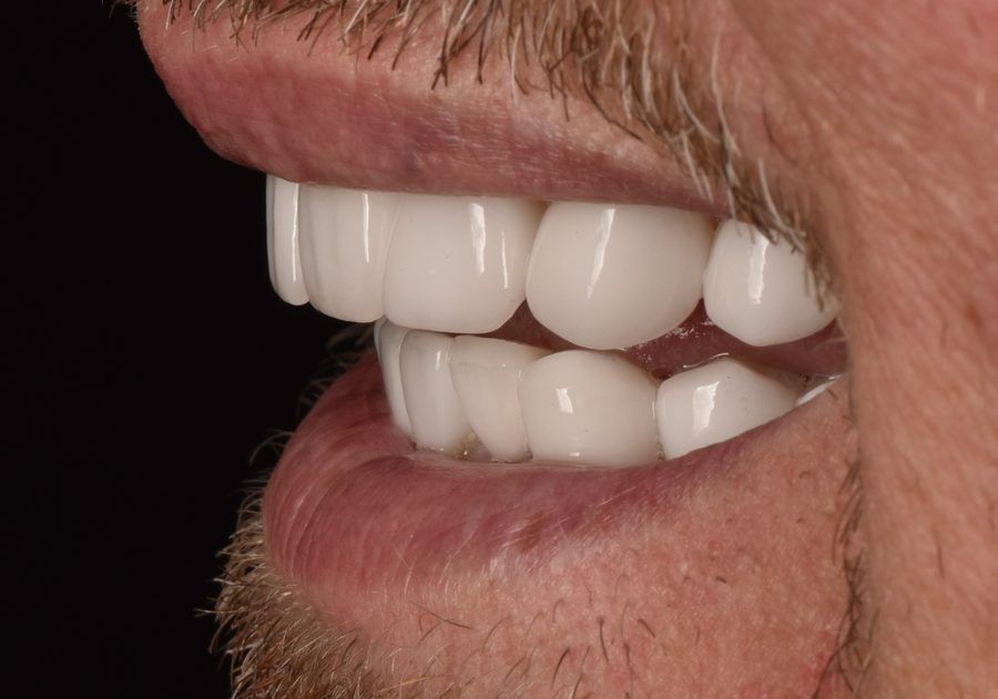 Close-up side view of a smiling mouth with white teeth and trimmed facial hair