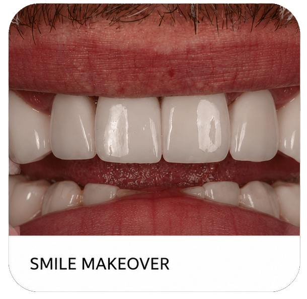 Close-up of a smile makeover showing white, straight teeth and lips with “SMILE MAKEOVER” text.