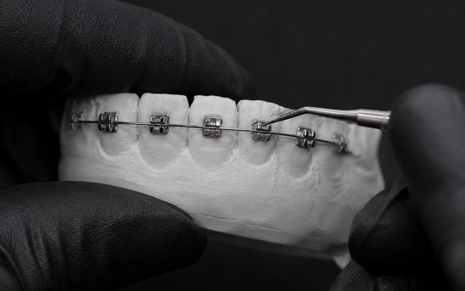 Teeth fitted with metal braces: stainless-steel brackets and an archwire, Yonsei Baro Orthodontics, Seoul