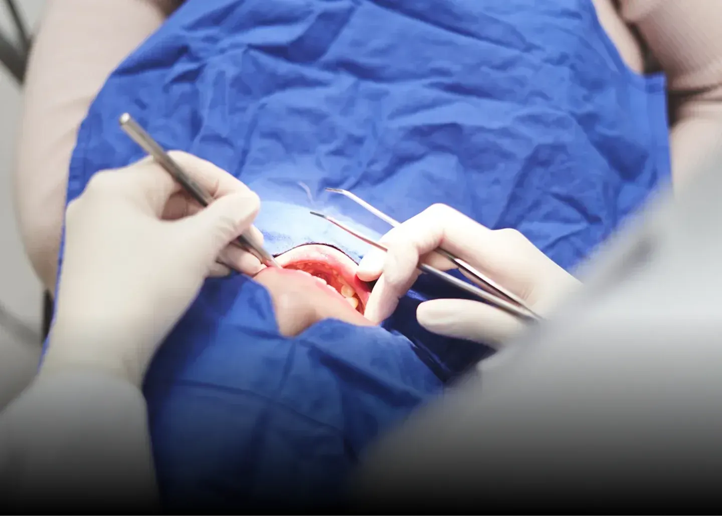 Retainer check-up after orthodontic treatment at Yonsei Baro, Seoul