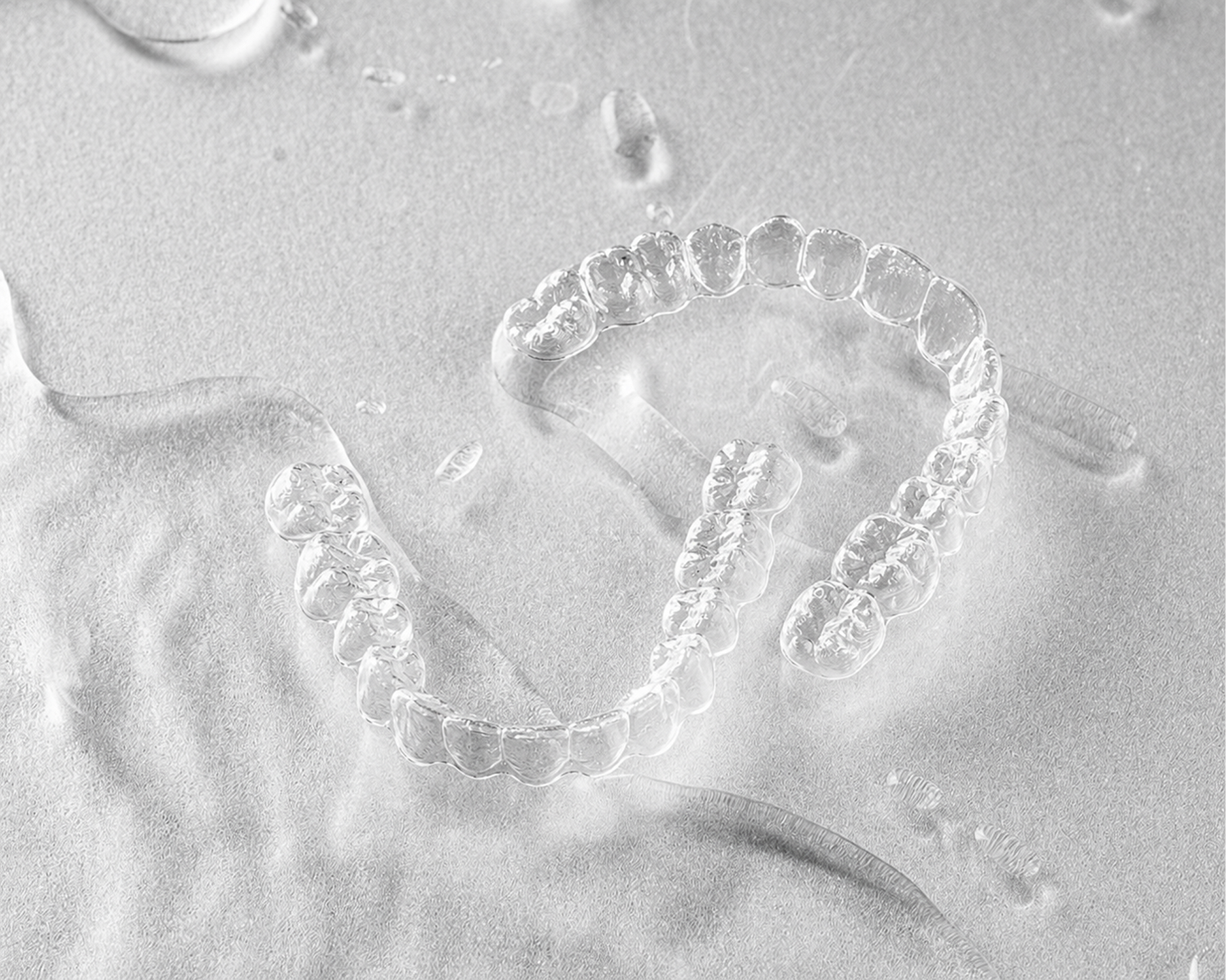Angel Aligner clear aligner used in orthodontic treatment at Yonsei Baro, Seoul