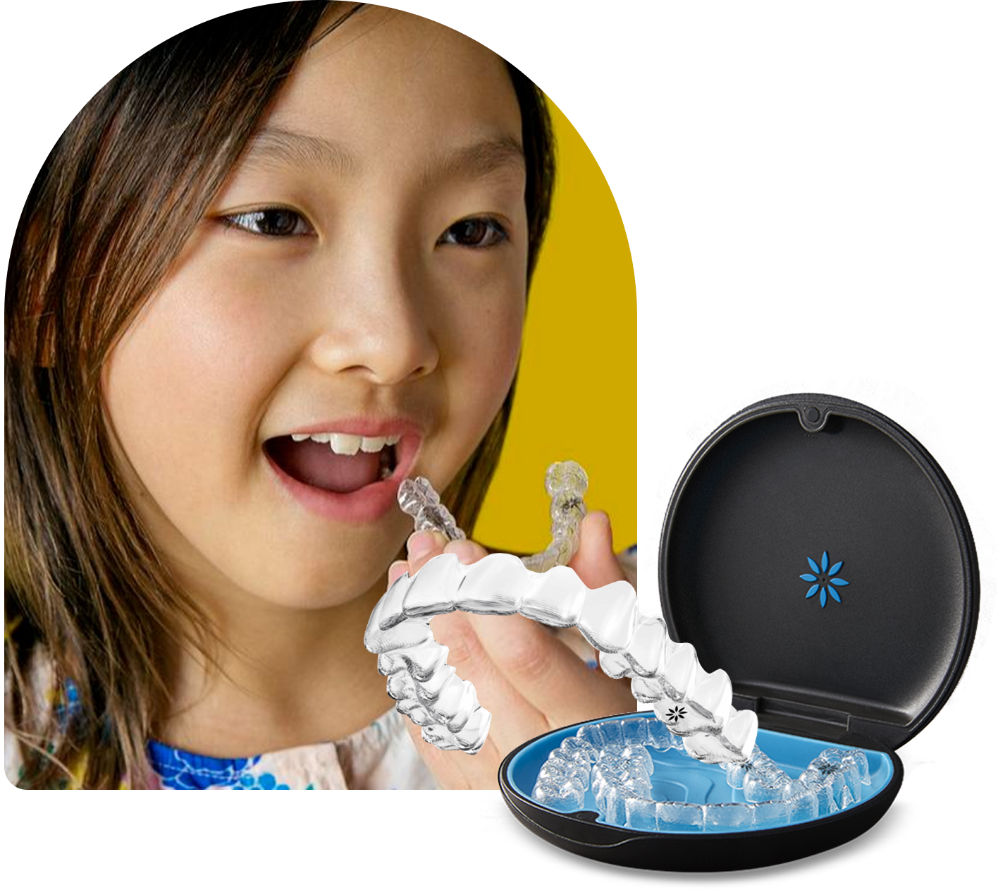 Child smiling while wearing Invisalign First clear aligners for early orthodontic treatment