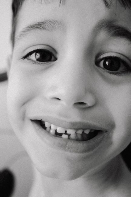 A smiling school-age child showing their front teeth