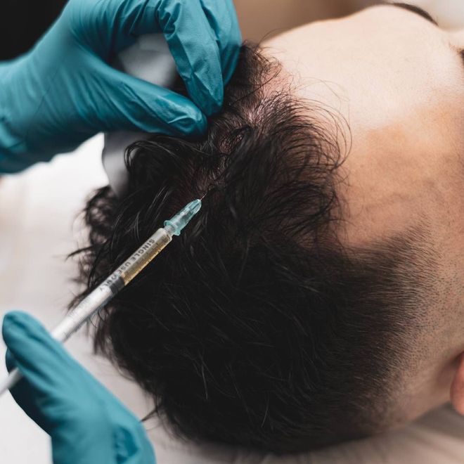 A man is getting an injection in his hair.