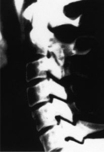 chiropractor with newborn