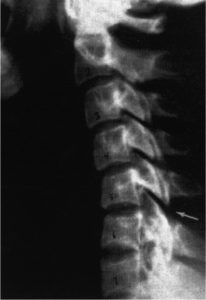 chiropractor with newborn