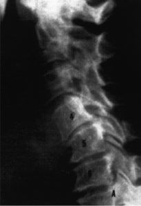 chiropractor with newborn
