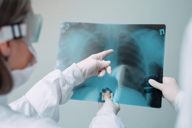 Medical personnel examining an X-ray of lungs, pointing at the image while wearing protective gear.
