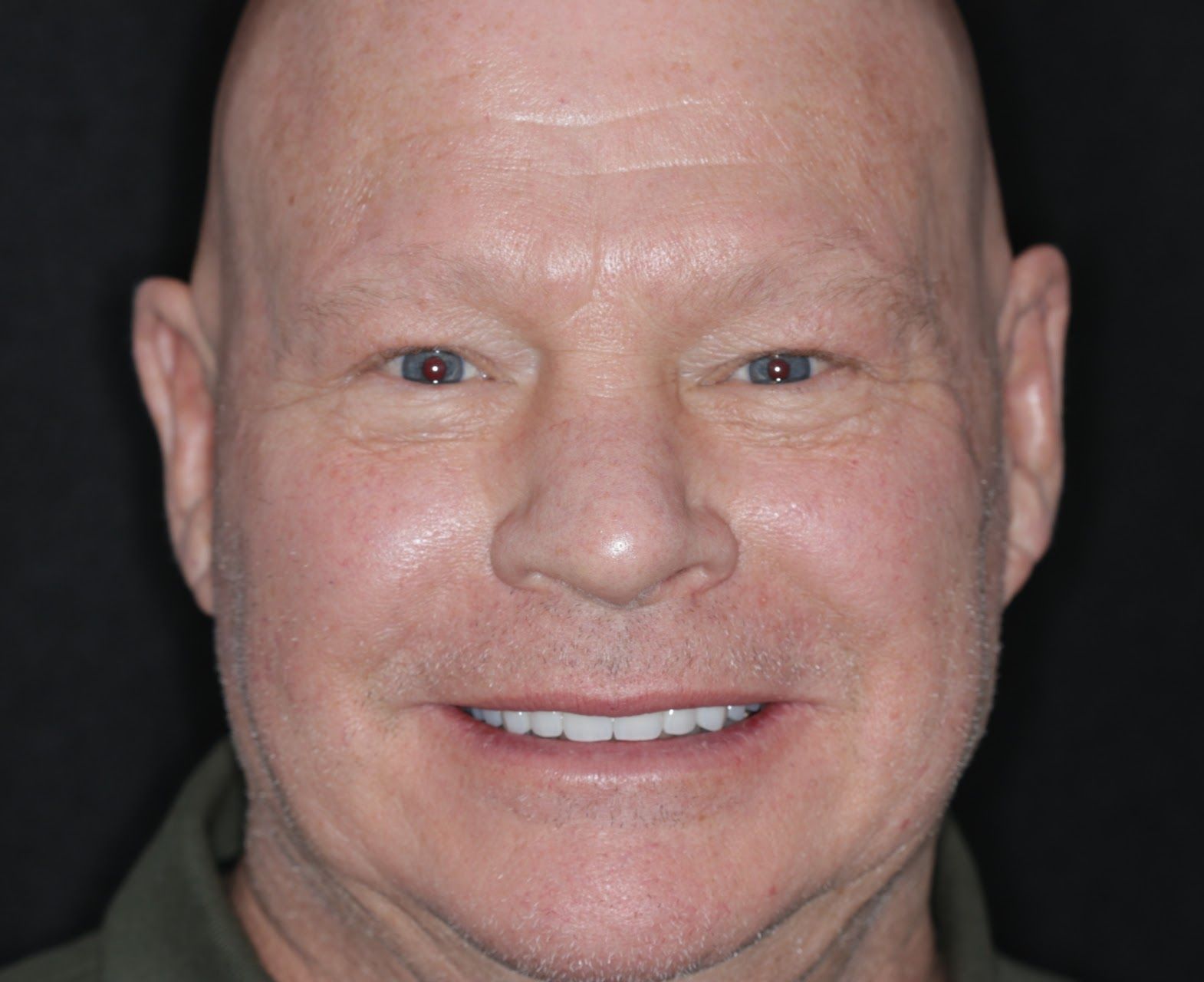 A close up of a man 's face with a smile on his face.