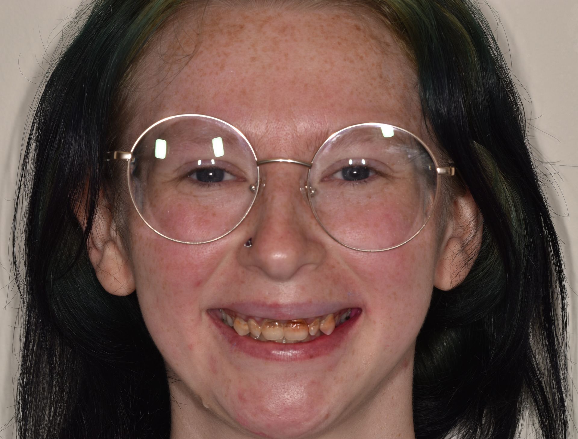 A young girl wearing glasses is smiling for the camera