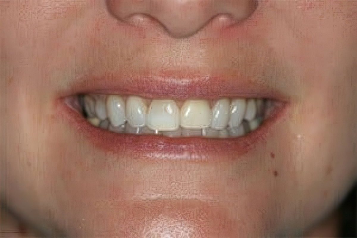 Close-up of a smiling mouth showing teeth and lips