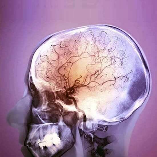 Radiología digital Radiología digital