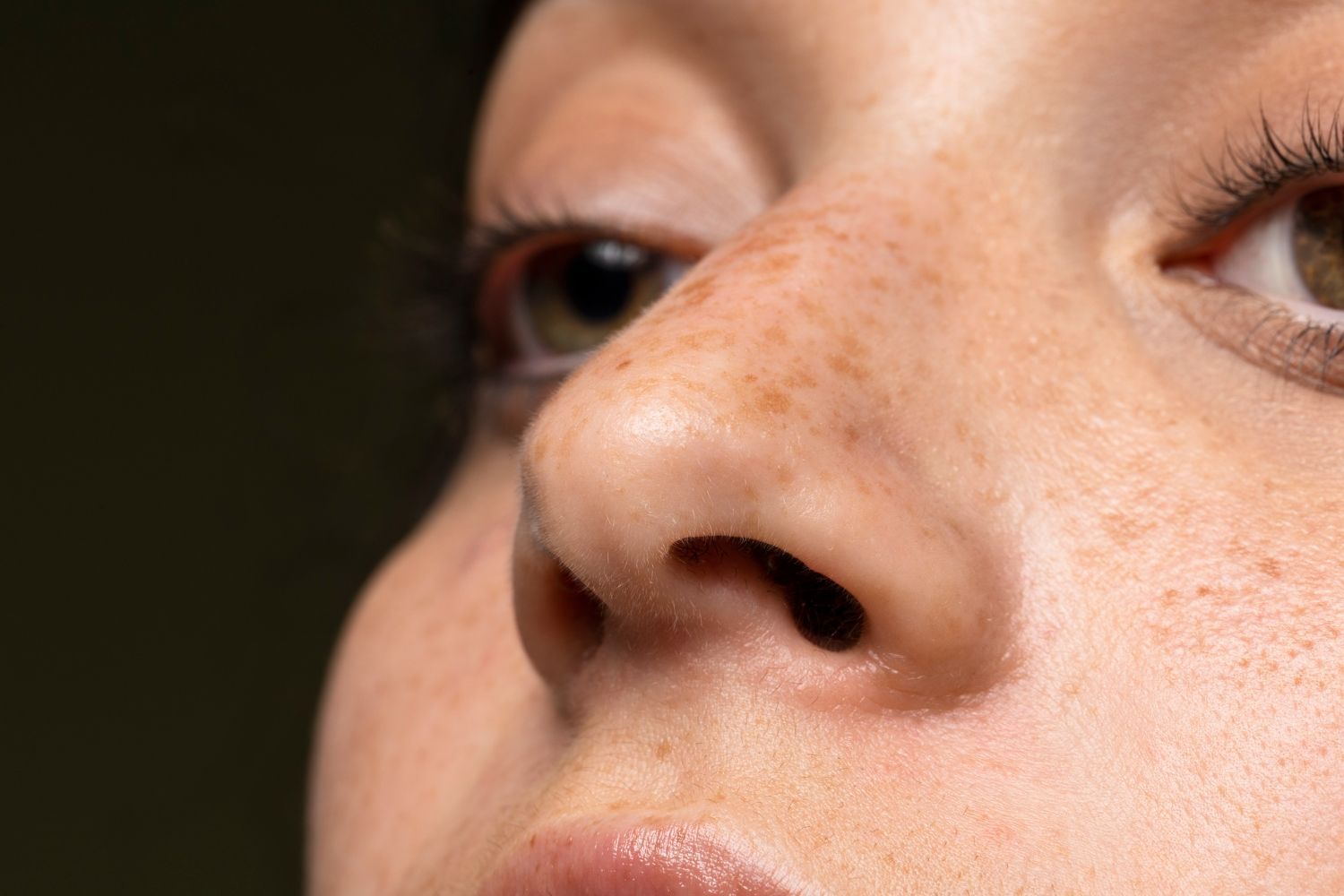 Close-up of a face showing nose and eyes with freckles against a dark background