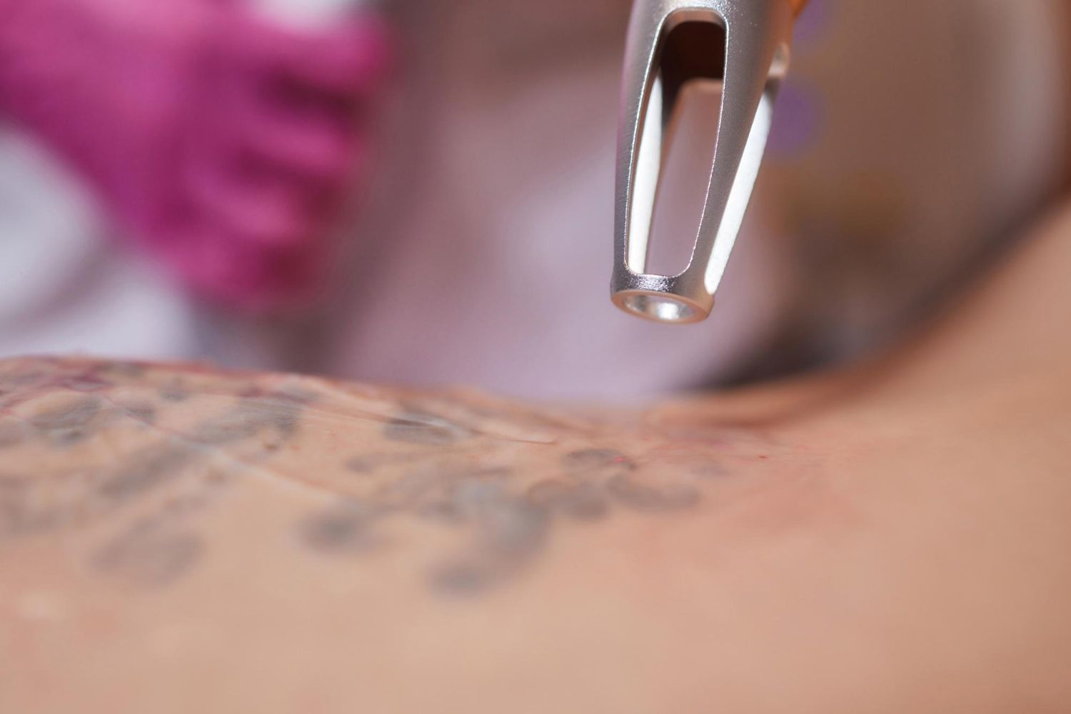 Close-up of a tattoo being worked on with a handheld tattoo machine
