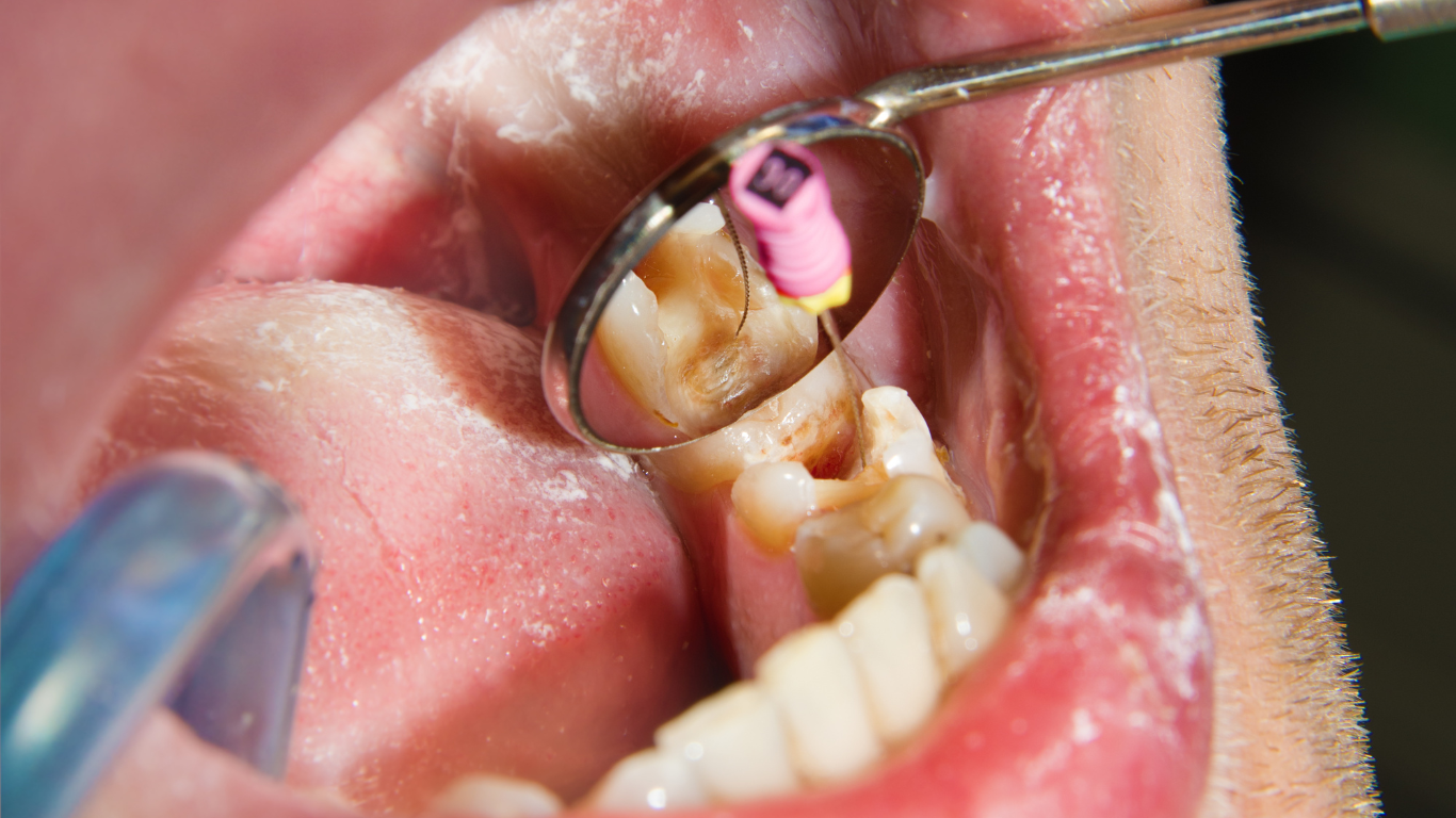 A young boy is sitting in a dental chair giving a thumbs up.
