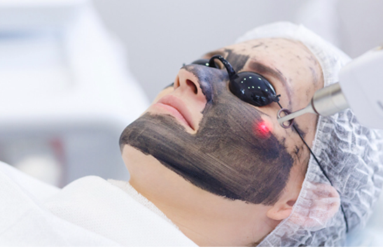 Carbon Laser Facial - Black Doll