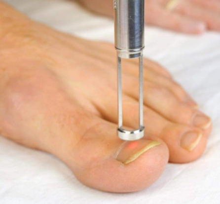 Nail infection treatment