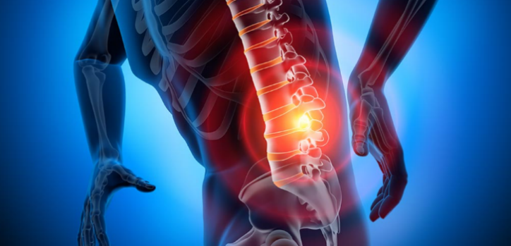 senile scoliosis