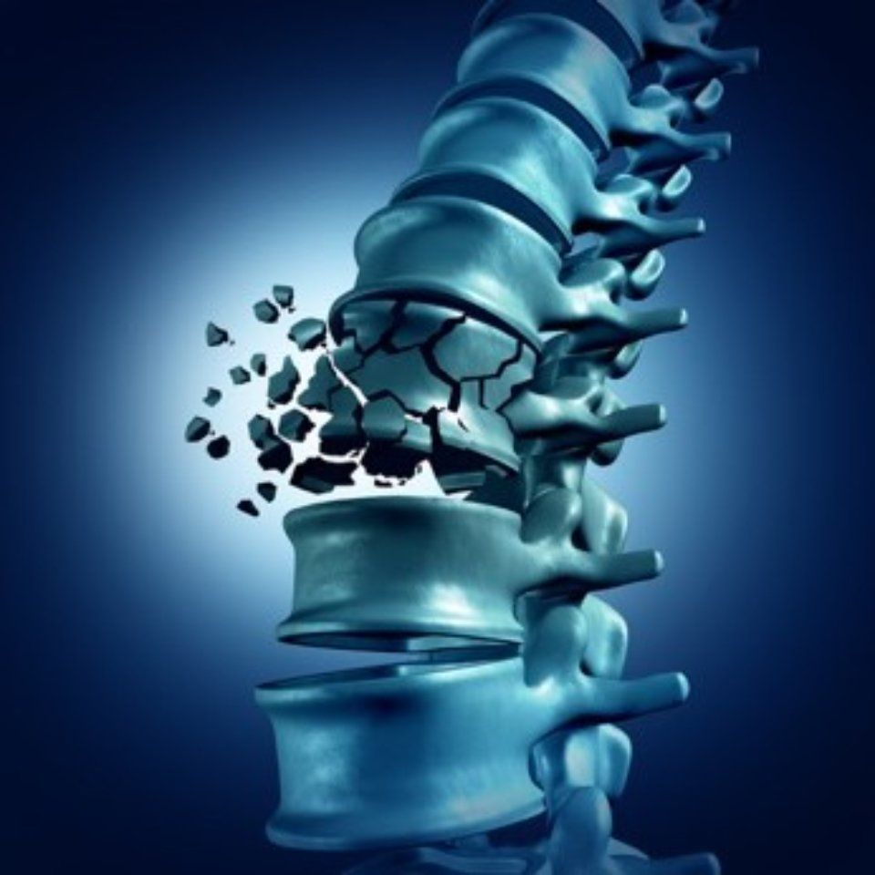 fractured bone