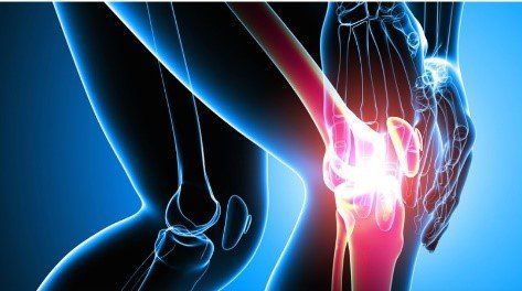 fractured bone