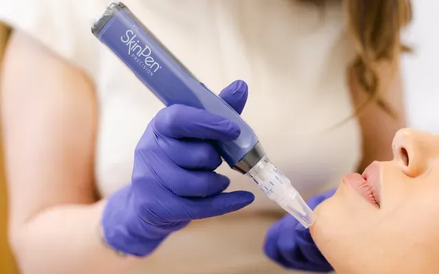Microneedling Leeds Advanced Skin Rejuvenation