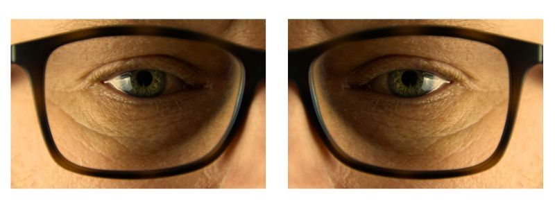 Polynucleotides for Eyes