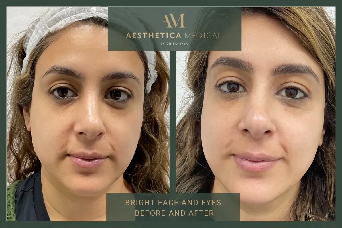 bright face and eyes before and after treatment