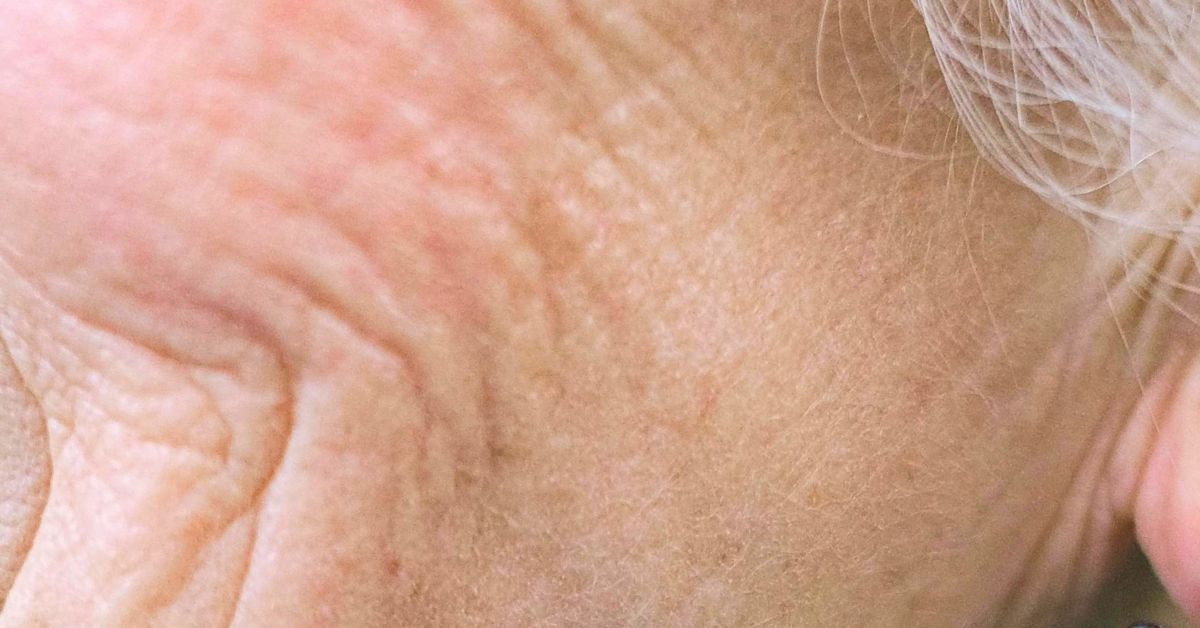 Close up of crepey skin