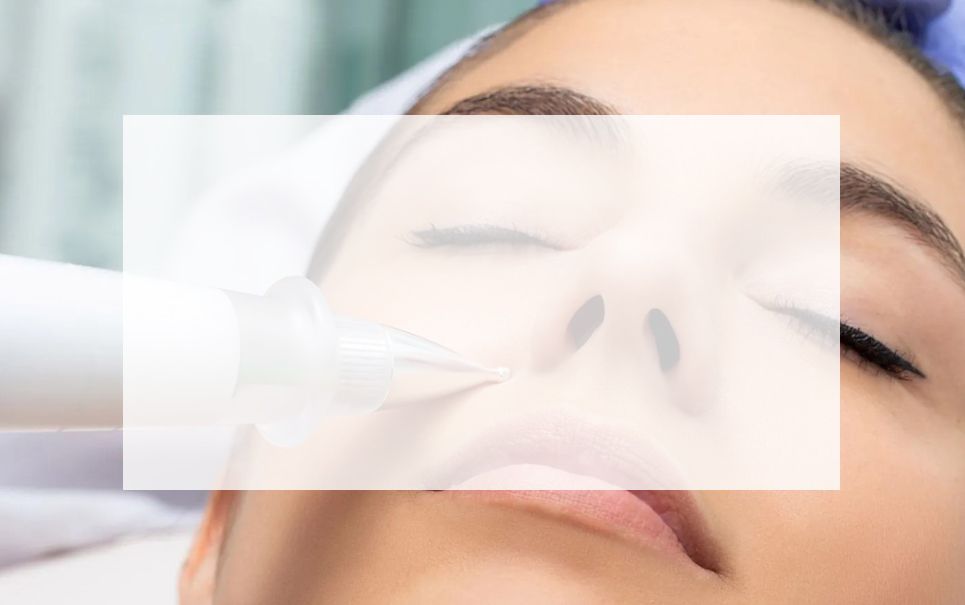 PATIENT HAVING CRYOPEN TREATMENT