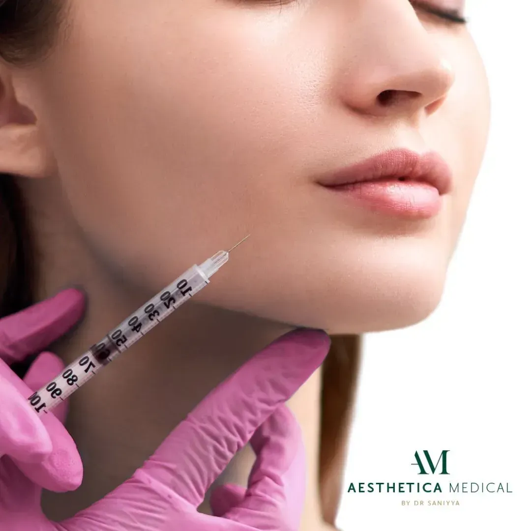 Dermal fillers for marionette lines