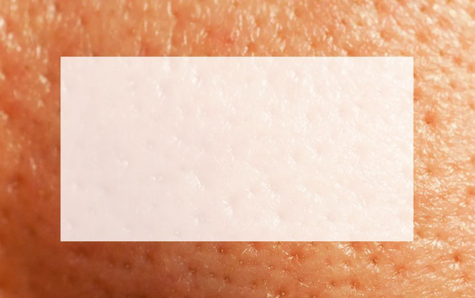 Enlarged Pore Image