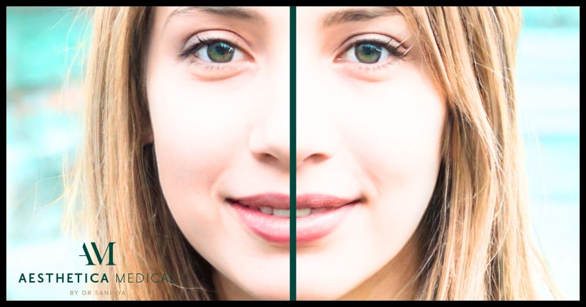 Womans face with line down the middle indicating symmetry