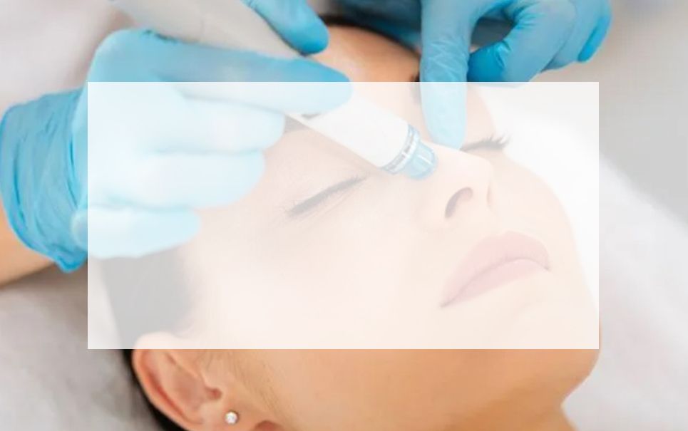 hydra-peel patient
