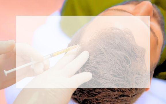 PRP FOR HAIR LOSS PATIENT