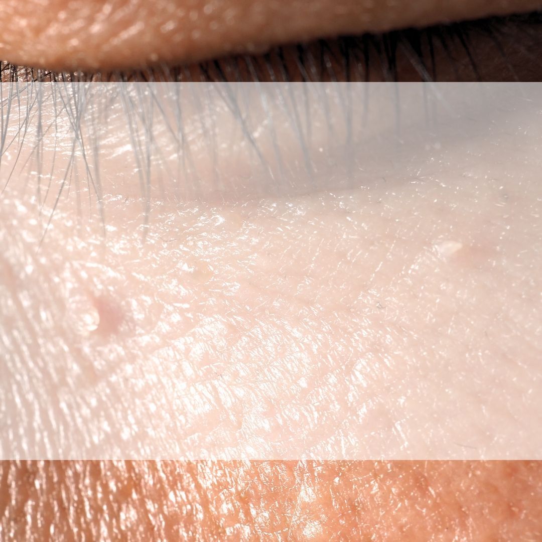 A close up of a person 's eye with a white border