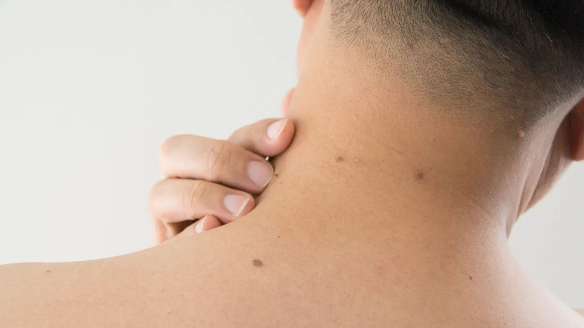 Skin tag removal leeds