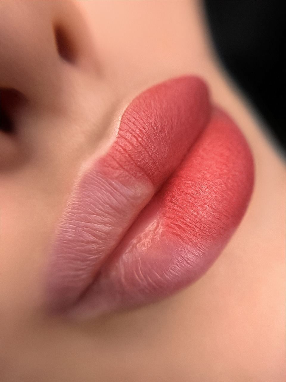 Lippenpigmentierung in Hildesheim