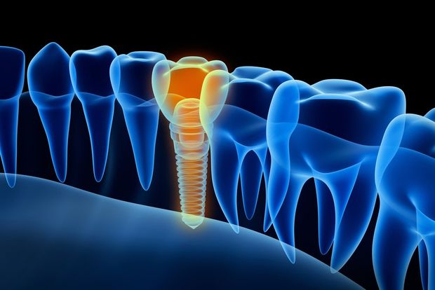 prestazioni odontoiatriche