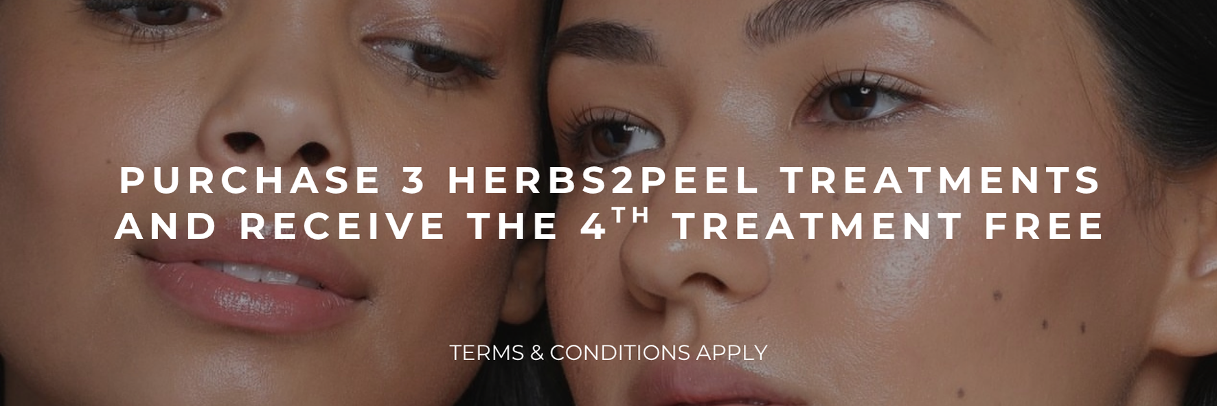 Promotional banner with two faces and text: “Purchase 3 Herbs2Peel treatments and receive the 4th treatment free”