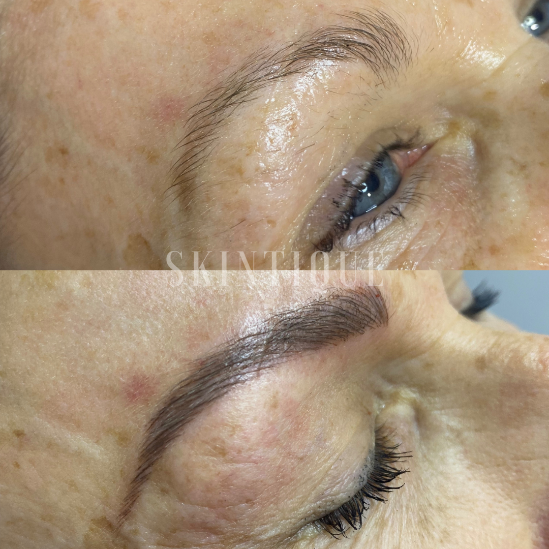 Before-and-after close-up of an eyebrow tattoo or microblading procedure on a closed eye.