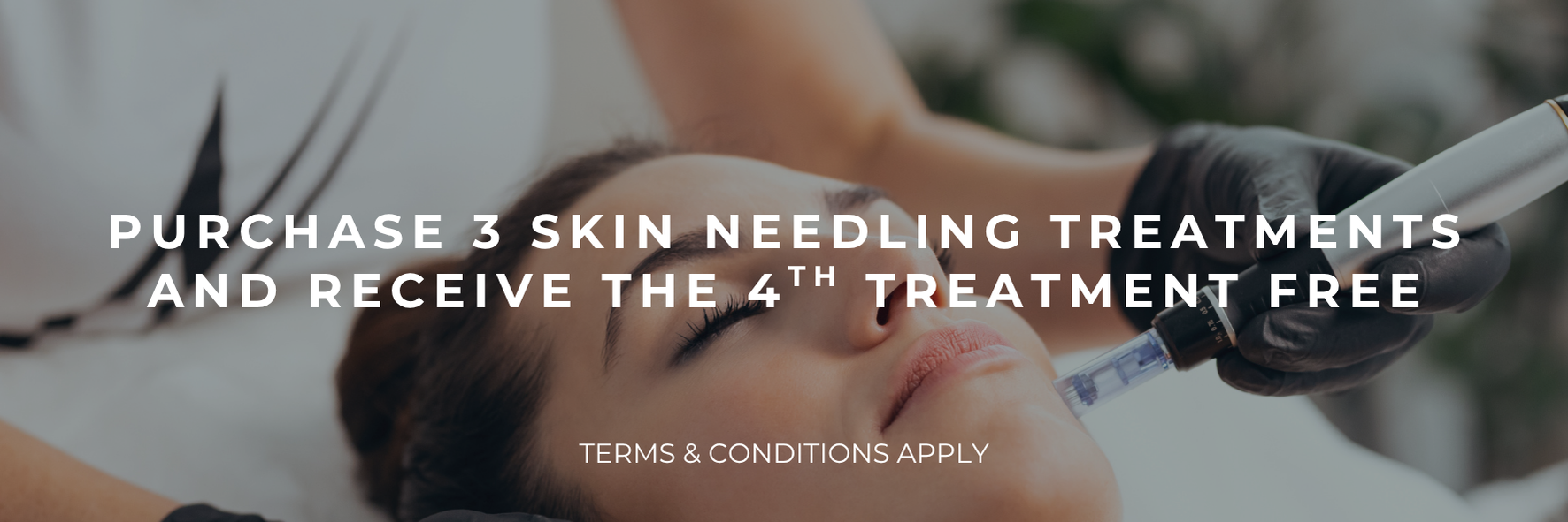 Promotional banner: āPurchase 3 skin needling treatments and receive the 4th treatment freeā over a facial image