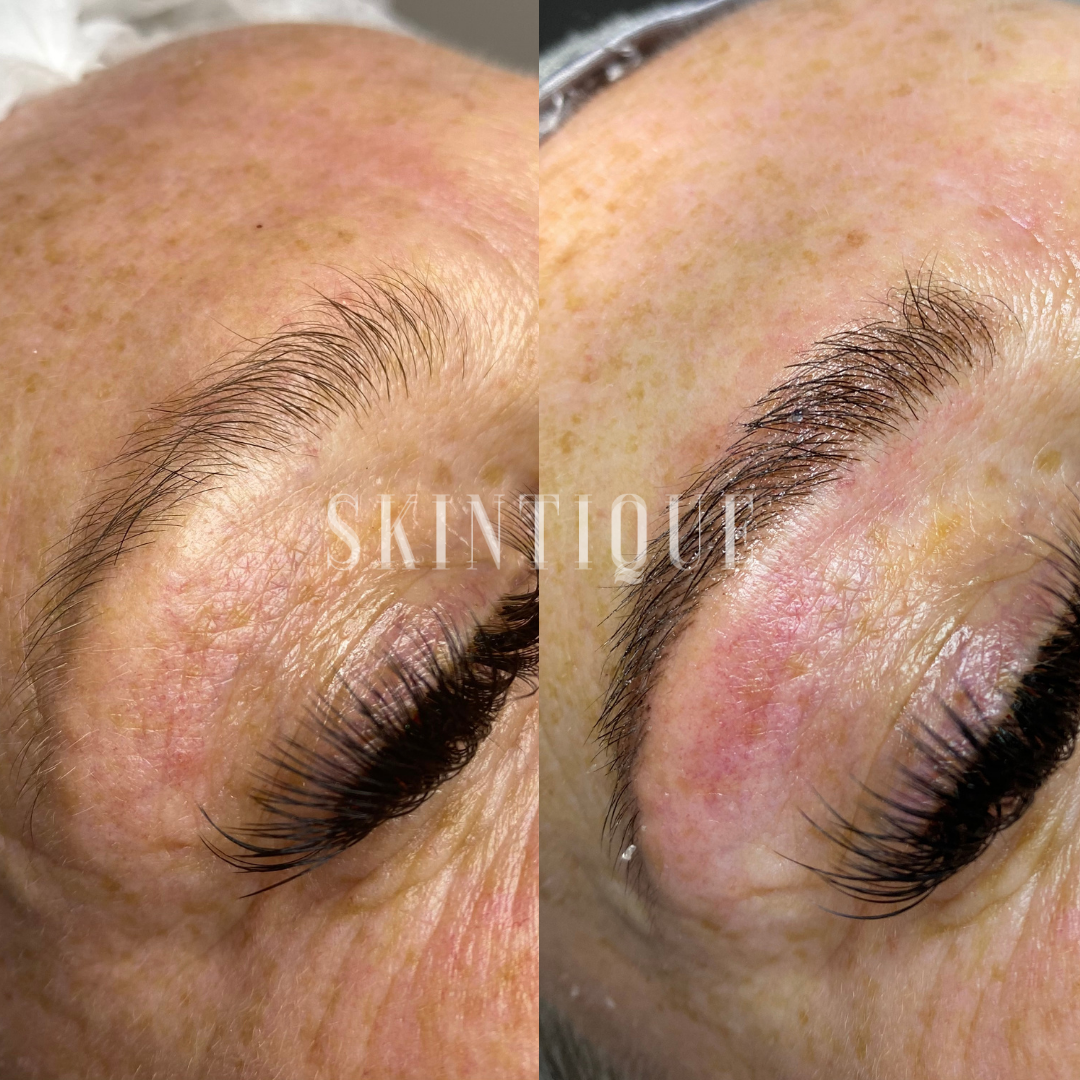 Close-up of eyebrow microblading before and after healing on a woman’s closed eye