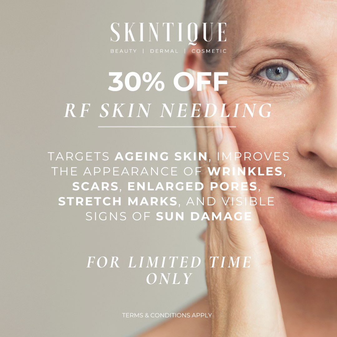 Skintique skincare promo with woman’s face, “30% off RF skin needling” and treatment benefits text