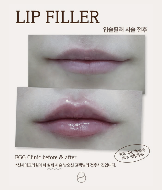 Affordable Glutathion IV Therapy in Seoul | Gangnam Egg Clinic