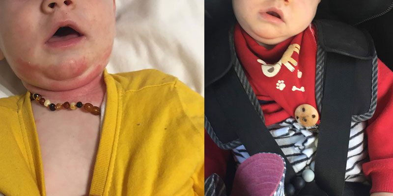 Two pictures of a baby wearing a necklace and a scarf.